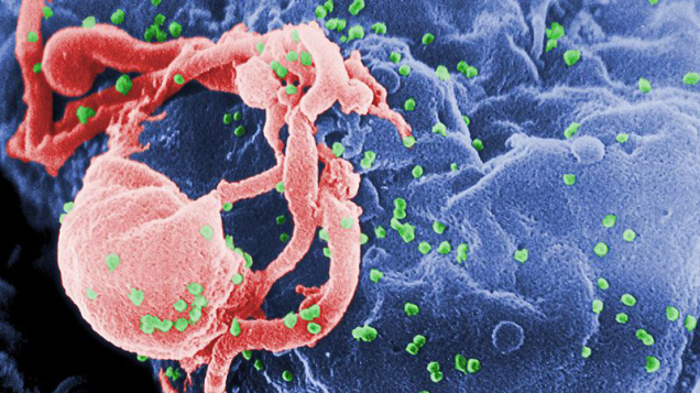 Przełom w medycynie? Zmutowany wirus HIV wyleczył ciężkie choroby genetyczne